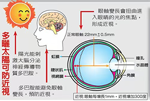 硬核科普：从多巴胺到周边离焦，教你科学防近视